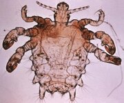 Pthirus_pubis_-_crab_louse.jpg