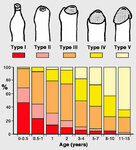 foreskin_exposure_stages_kayaba_96.jpg