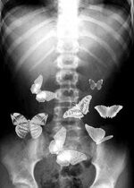 59f956840f666df848be07b8aa08017d--x-rays-give-me-butterflies.jpg